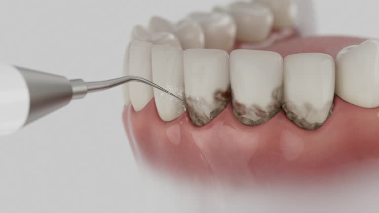 Trusted Dental Implants service in Dayton, VA - Dentist Open Now